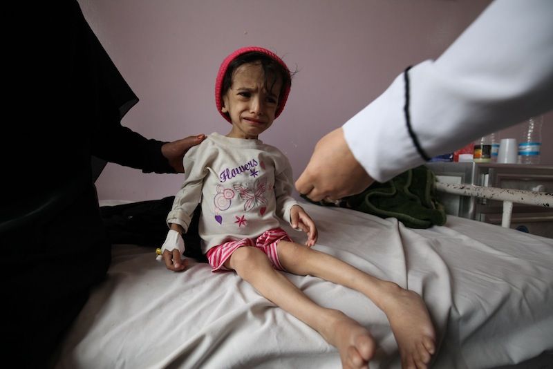 Más De 20 Millones De Personas En Yemen Necesitan Ayuda Onu 6661